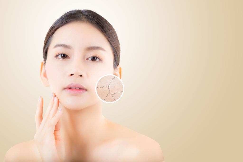 Cách chọn kem lotion dưỡng ẩm da mặt dành cho da khô